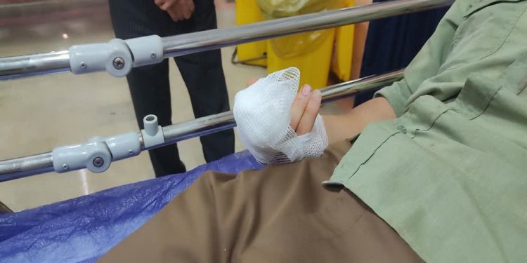 قطع انگشت دست مامور منابع طبیعی بابل در حمله متصرف اراضی ملی