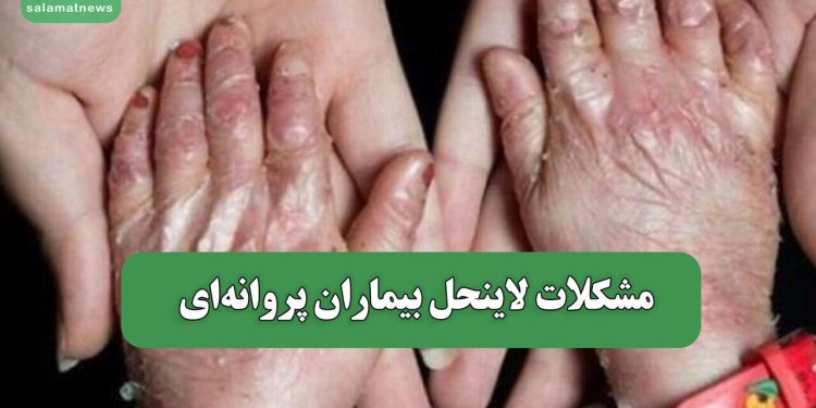 مشکلات لاینحل بیماران پروانهای