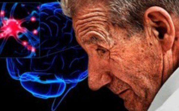 ارتباط سندرم متابولیک با بیماری پارکینسون