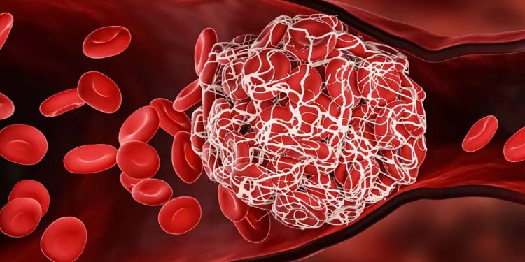 کووید ۱۹ و خطر پنهان آن برای زنان؛ پیری زودرس رگهای خونی