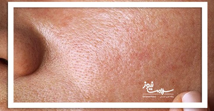 مسیر اشتباه برای درمان مشکلات پوستی