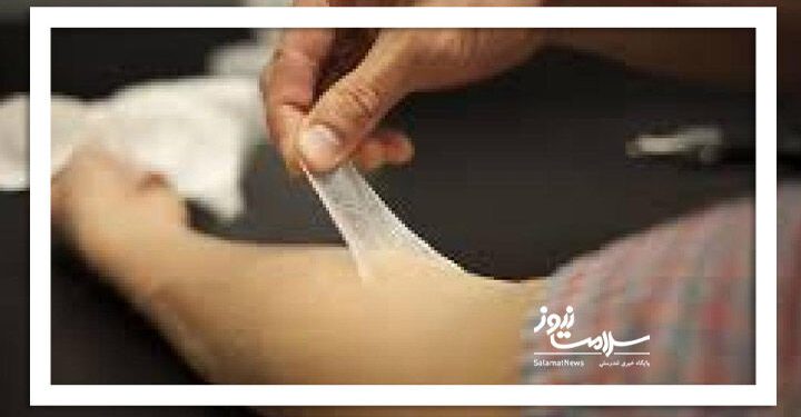 دانشمندان ایرانی موفق به ساخت پوست انسانی شدند