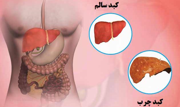 بهبود سلامت کبد با رویکرد تغذیه‌ای سالم: راهنمای عملی