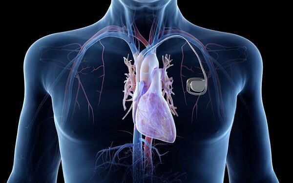 رسوبات پنهان چربی پیری قلب را تسریع می‌کنند