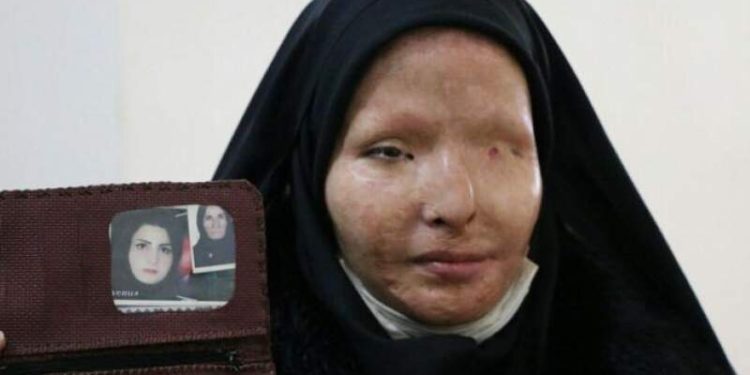 بخشش بزرگ بعد از ۱۱ سال؛ سیما افشاری کیست؟/ عکس