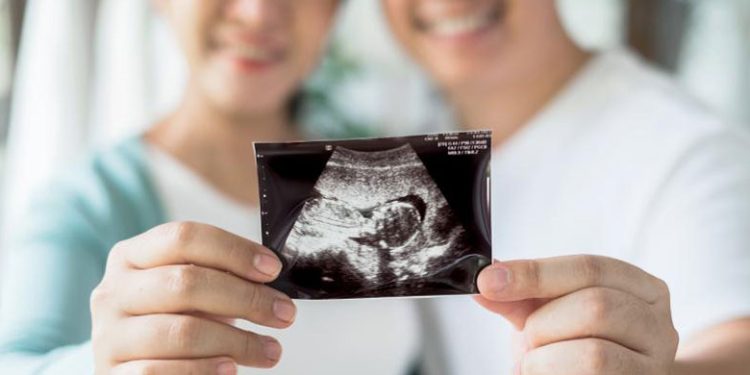 چرا انتخاب مرکز معتبر برای سونوگرافی، خیال مادران را راحت می کند؟