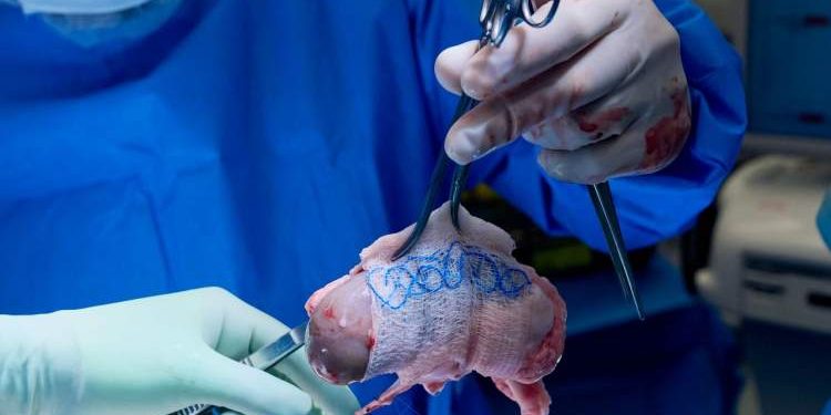 آغاز دوره‌ای تازه در پیوند اعضا؛ FDA مجوز کارآزمایی کلیه‌ ویرایش‌شده ژنتیکی خوک را صادر کرد