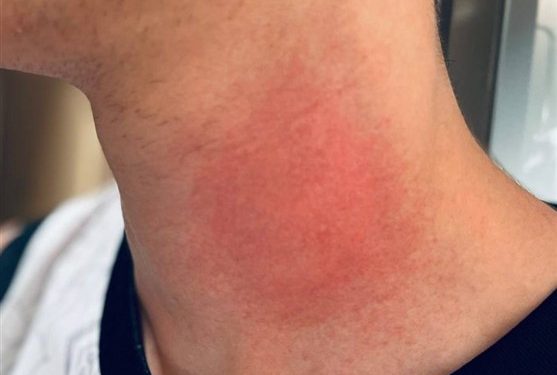 مشتِ خطا یا تمارض؟؛ اختلاف نظر داوران درباره فینال پرحاشیه حاجیموسایی فیلم و عکس