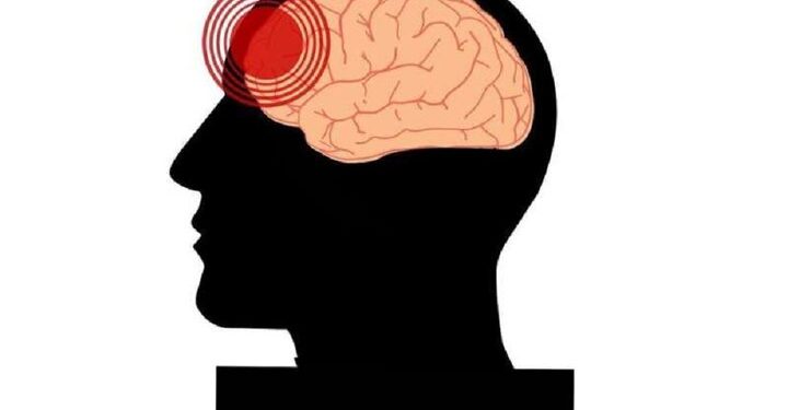 آسیب‌های تروماتیک مغزی در افراد مسن با افزایش خطر زوال عقل مرتبط است