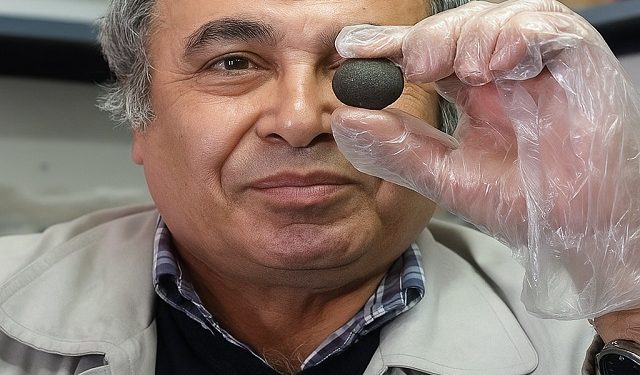 آسیب شدید به چشم مصنوعی شهر سوخته